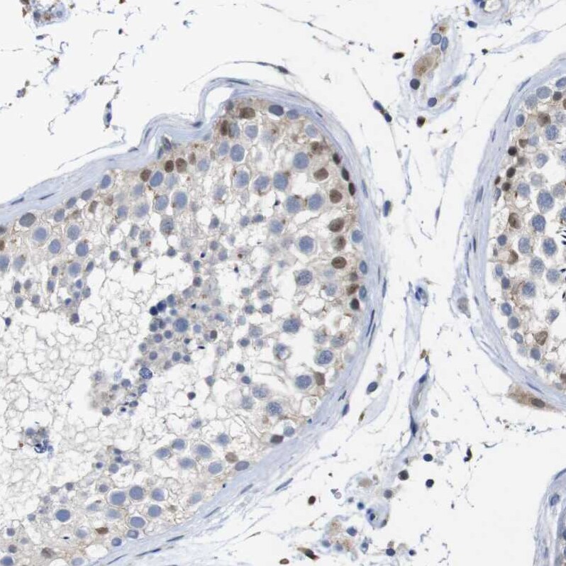 WW domain binding protein 5 Antibody - BSA Free Immunohistochemistry-Paraffin: WW domain binding protein 5 Antibody - BSA Free [NBP1-84208]