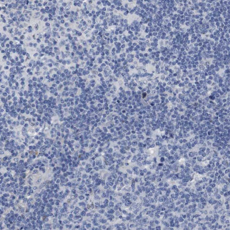 WW domain binding protein 5 Antibody - BSA Free Immunohistochemistry-Paraffin: WW domain binding protein 5 Antibody - BSA Free [NBP1-84208]