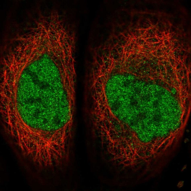 SERTAD4 Antibody - BSA Free Immunocytochemistry/ Immunofluorescence: SERTAD4 Antibody [NBP1-84216]