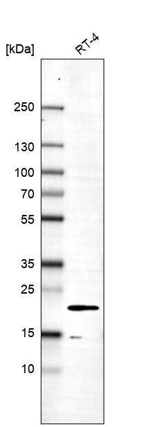 MOSPD1 Antibody Western Blot: MOSPD1 Antibody [NBP1-84220] -
