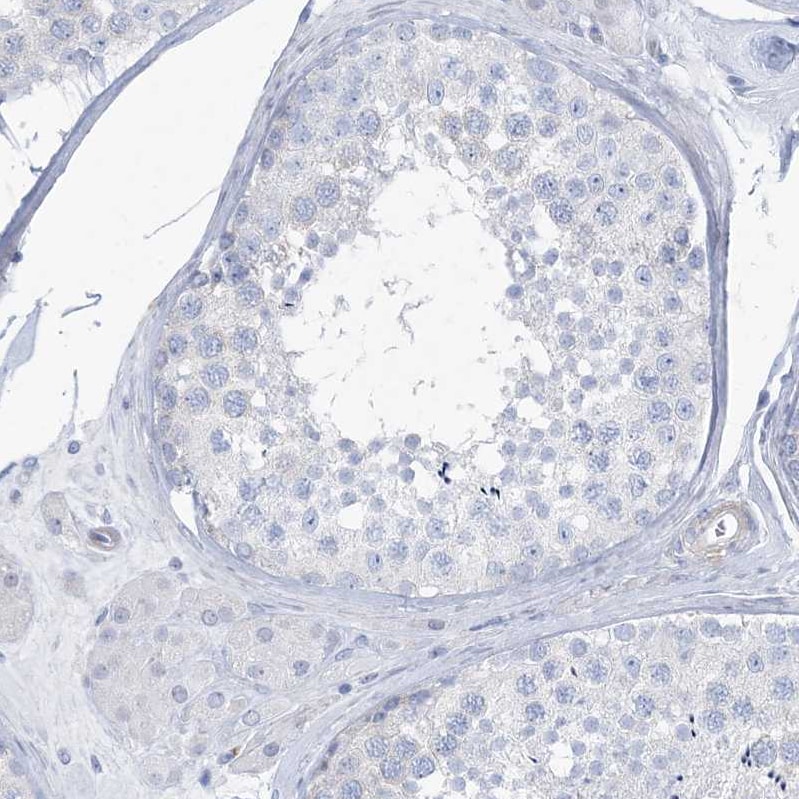 MOXD1 Antibody - BSA Free Immunohistochemistry-Paraffin: MOXD1 Antibody [NBP1-84233]
