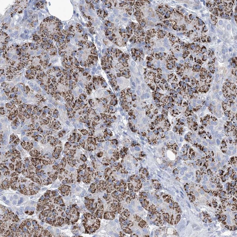 MOXD1 Antibody - BSA Free Immunohistochemistry-Paraffin: MOXD1 Antibody [NBP1-84233]
