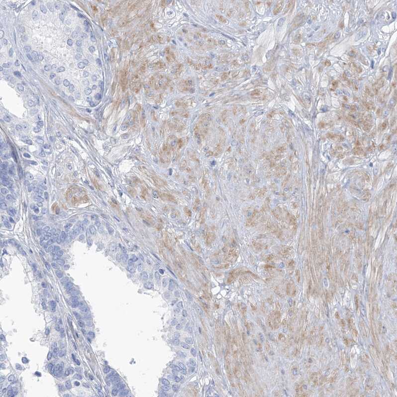 MOXD1 Antibody - BSA Free Immunohistochemistry-Paraffin: MOXD1 Antibody [NBP1-84233]