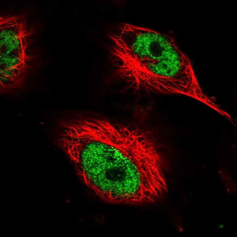 AHDC1 Antibody - BSA Free Immunocytochemistry/ Immunofluorescence: AHDC1 Antibody - BSA Free [NBP1-84238]