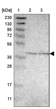 GPALPP1 Antibody - BSA Free Western Blot: GPALPP1 Antibody - BSA Free [NBP1-84240]