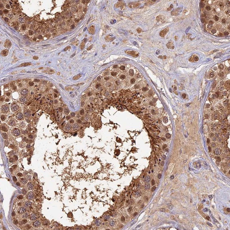 RSPH3 Antibody - BSA Free Immunohistochemistry-Paraffin: RSPH3 Antibody - BSA Free [NBP1-84245]