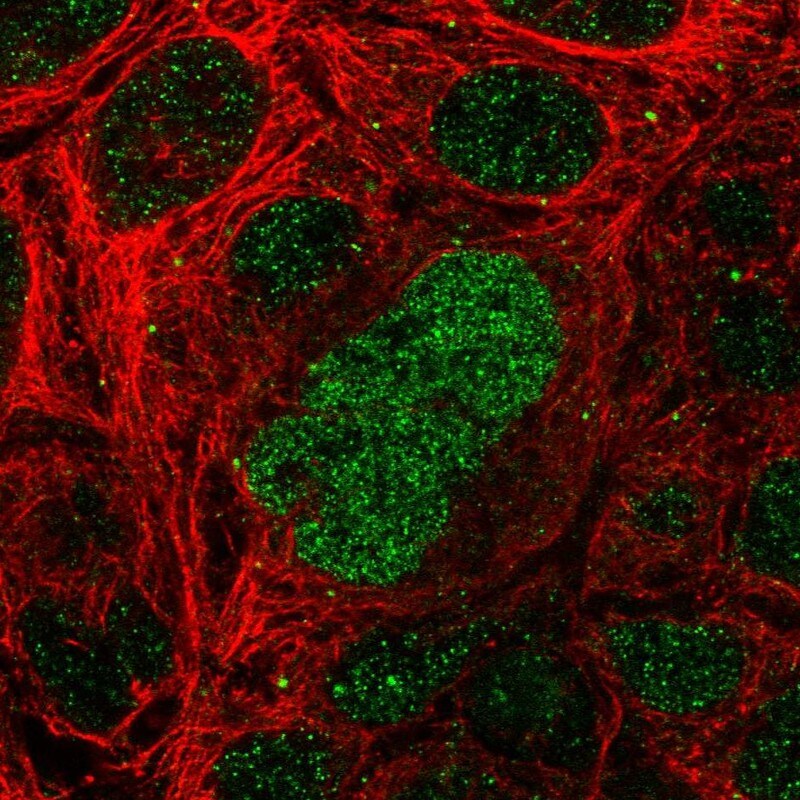 SALL4 Antibody - BSA Free Immunocytochemistry/ Immunofluorescence: SALL4 Antibody [NBP1-84247]