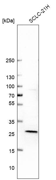 Deoxyguanosine kinase Antibody - BSA Free Western Blot: Deoxyguanosine kinase Antibody - BSA Free [NBP1-84256]