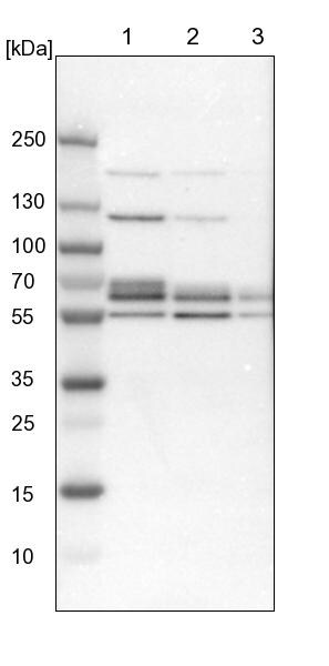 DGCR14 Antibody - BSA Free Western Blot: DGCR14 Antibody - BSA Free [NBP1-84257]