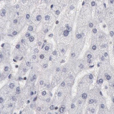 DGCR14 Antibody - BSA Free Immunohistochemistry-Paraffin: DGCR14 Antibody - BSA Free [NBP1-84258]