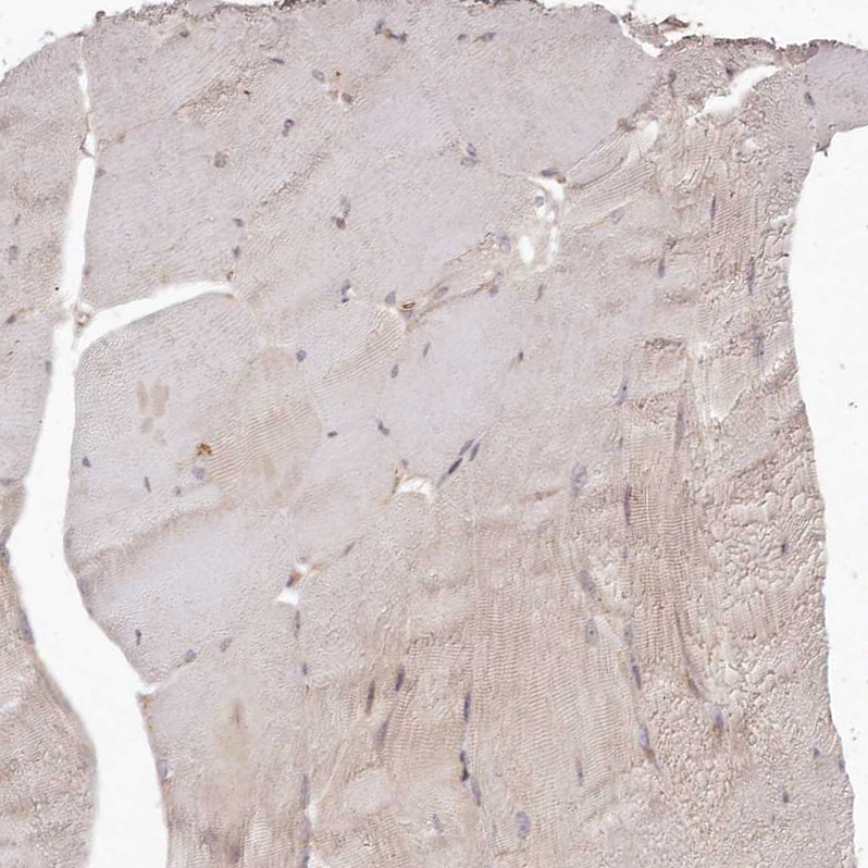 TMIE Antibody - BSA Free Immunohistochemistry-Paraffin: TMIE Antibody - BSA Free [NBP1-84260]