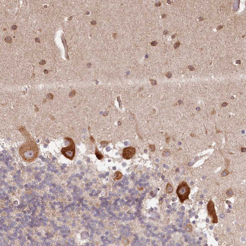 TMIE Antibody - BSA Free Immunohistochemistry-Paraffin: TMIE Antibody - BSA Free [NBP1-84260]