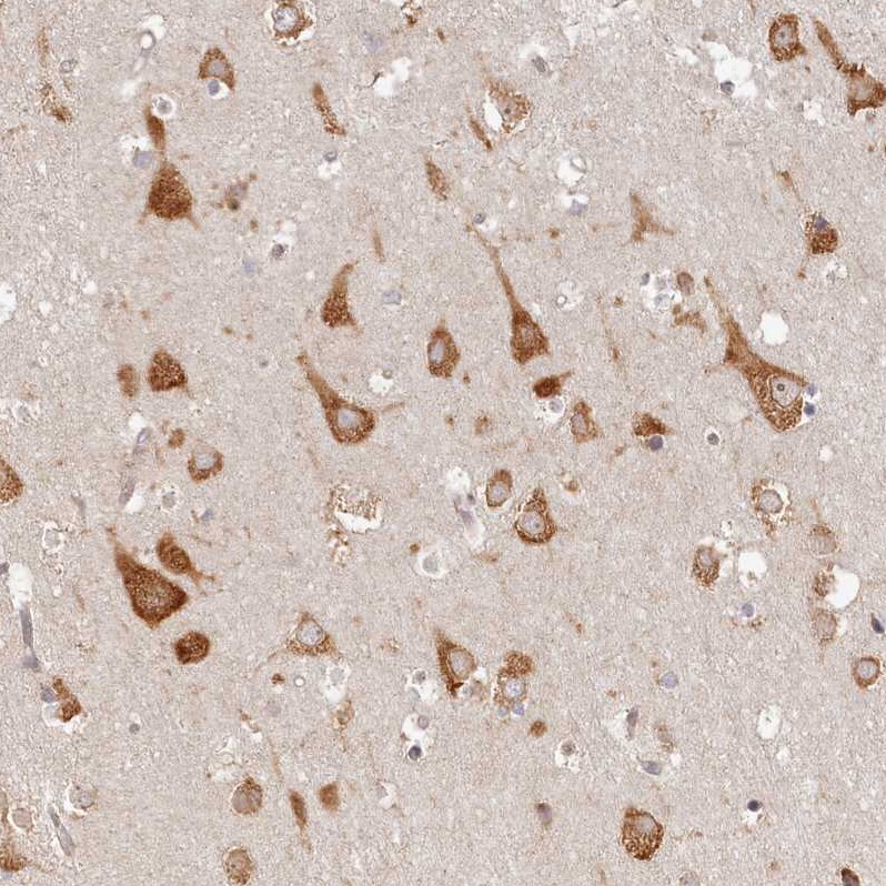 TMIE Antibody - BSA Free Immunohistochemistry-Paraffin: TMIE Antibody - BSA Free [NBP1-84260]