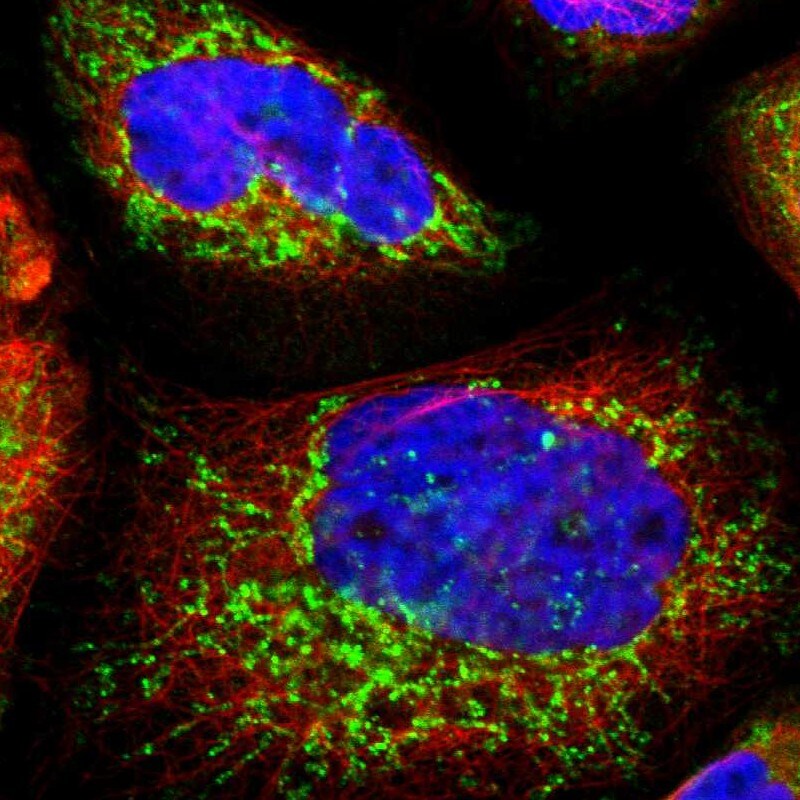 SMAC/Diablo Antibody - BSA Free Immunocytochemistry/ Immunofluorescence: SMAC/Diablo Antibody [NBP1-84262]