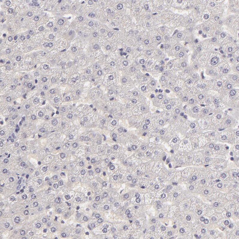 SIX1 Antibody - BSA Free Immunohistochemistry-Paraffin: SIX1 Antibody - BSA Free [NBP1-84264]
