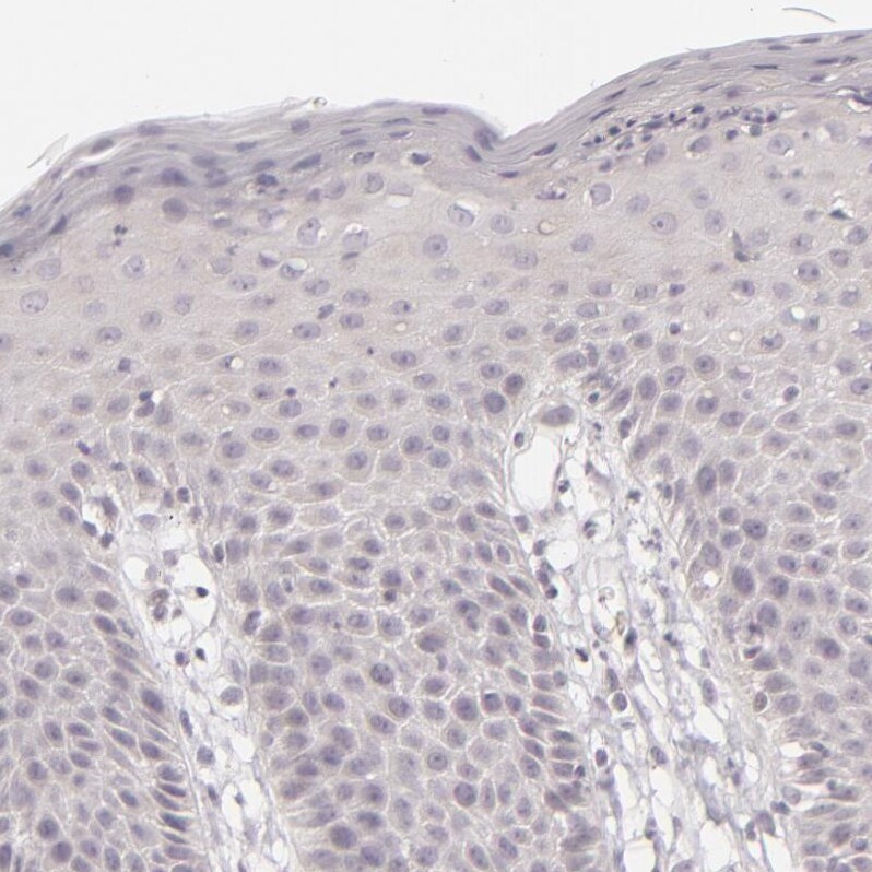 SIX1 Antibody - BSA Free Immunohistochemistry-Paraffin: SIX1 Antibody - BSA Free [NBP1-84264]