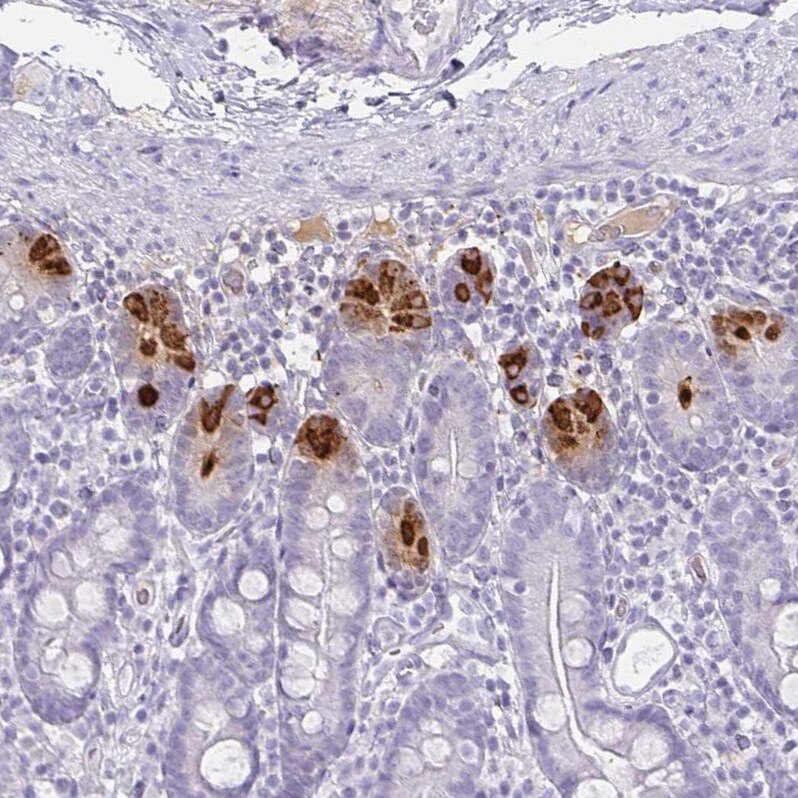 DEFA6 Antibody - BSA Free Immunohistochemistry-Paraffin: DEFA6 Antibody - BSA Free [NBP1-84281]