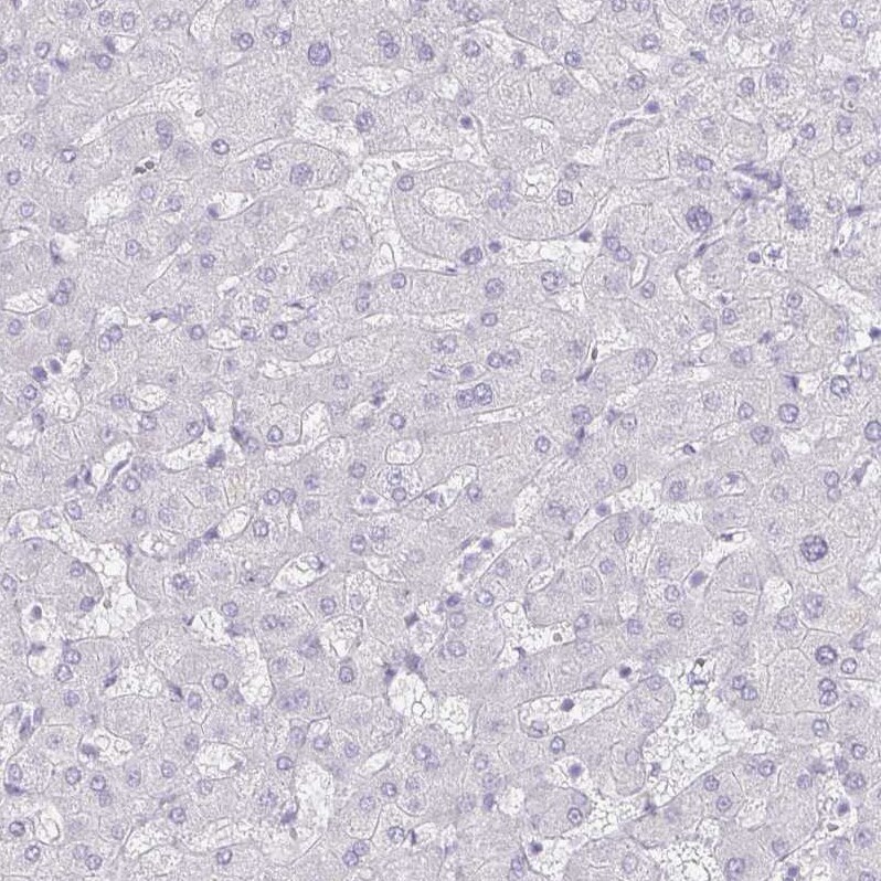 DEFA6 Antibody - BSA Free Immunohistochemistry-Paraffin: DEFA6 Antibody - BSA Free [NBP1-84281]
