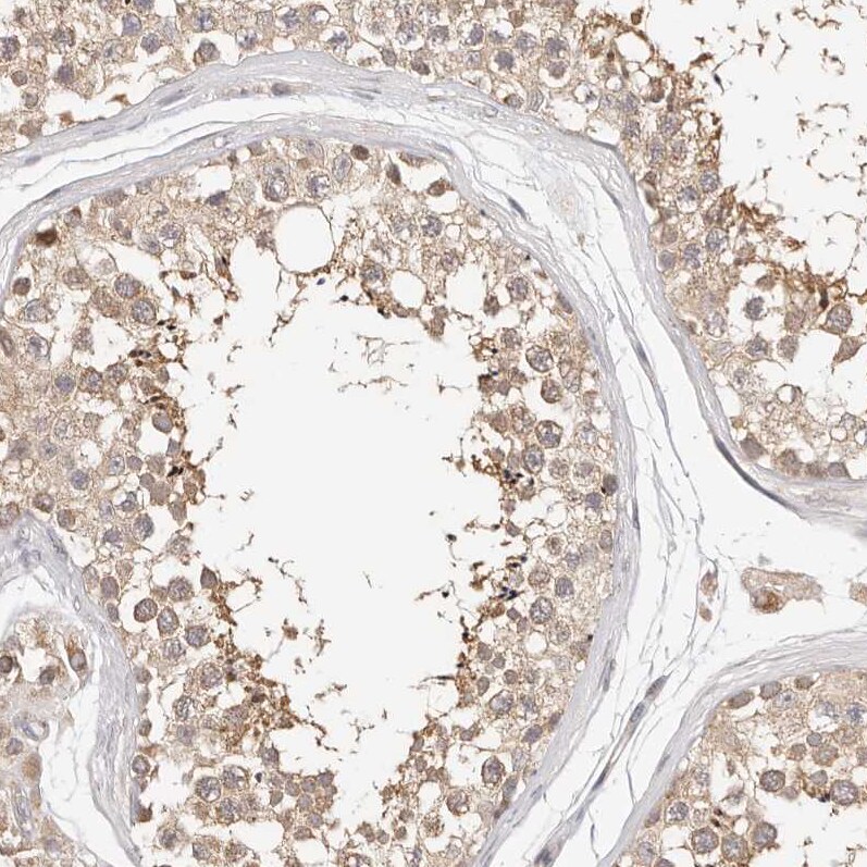 KCMF1 Antibody - BSA Free Immunohistochemistry-Paraffin: KCMF1 Antibody [NBP1-84283]