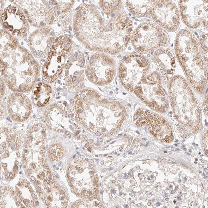 KCMF1 Antibody - BSA Free Immunohistochemistry-Paraffin: KCMF1 Antibody [NBP1-84283]