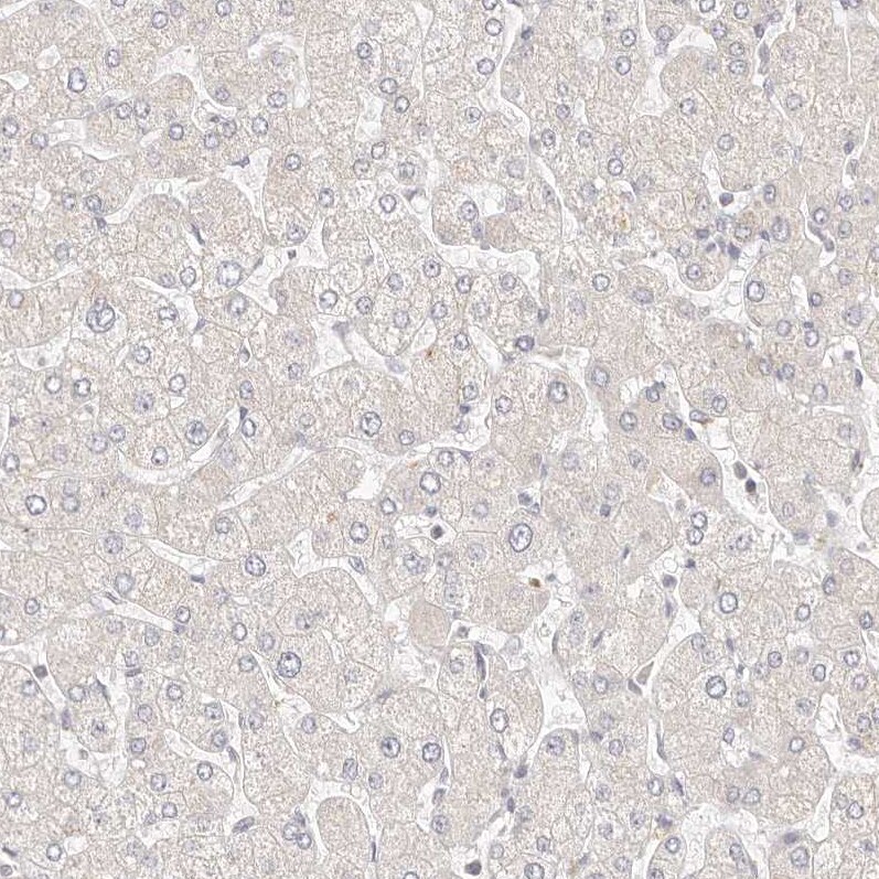 KCMF1 Antibody - BSA Free Immunohistochemistry-Paraffin: KCMF1 Antibody [NBP1-84283]