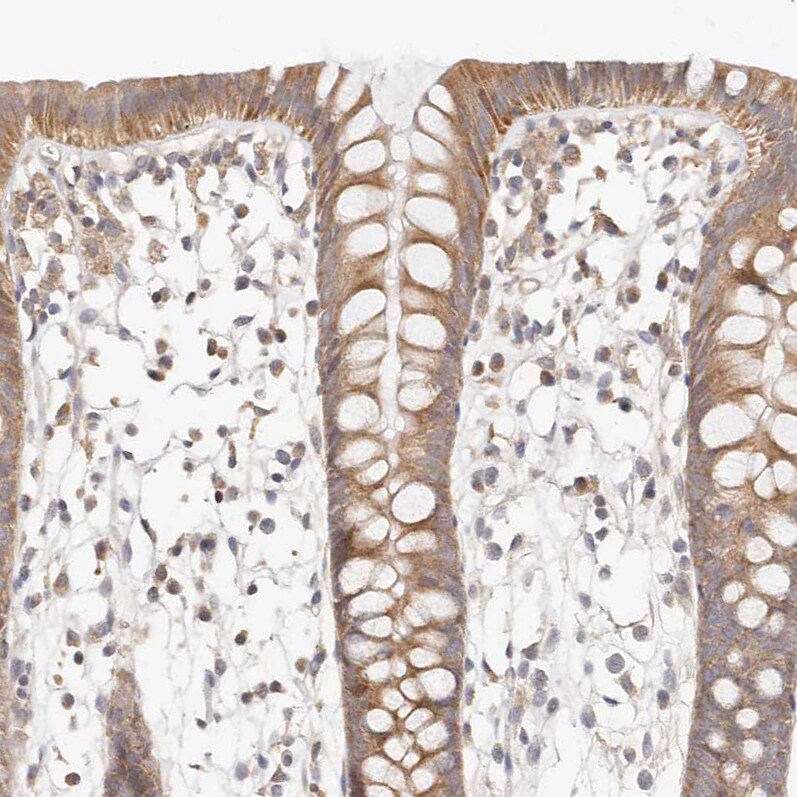 KCMF1 Antibody - BSA Free Immunohistochemistry-Paraffin: KCMF1 Antibody [NBP1-84283]