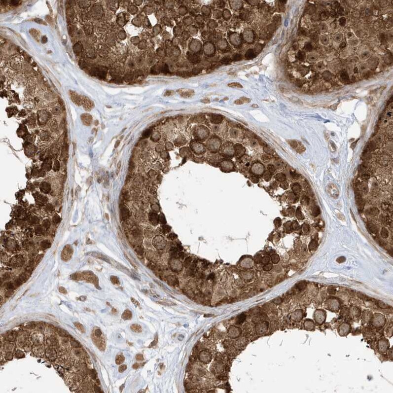 DHX36 Antibody - BSA Free Immunohistochemistry-Paraffin: DHX36 Antibody - BSA Free [NBP1-84286]