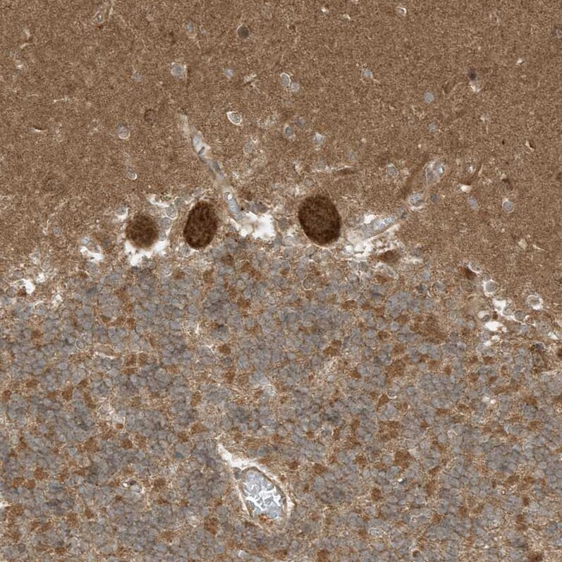 DHX36 Antibody - BSA Free Immunohistochemistry-Paraffin: DHX36 Antibody - BSA Free [NBP1-84286]
