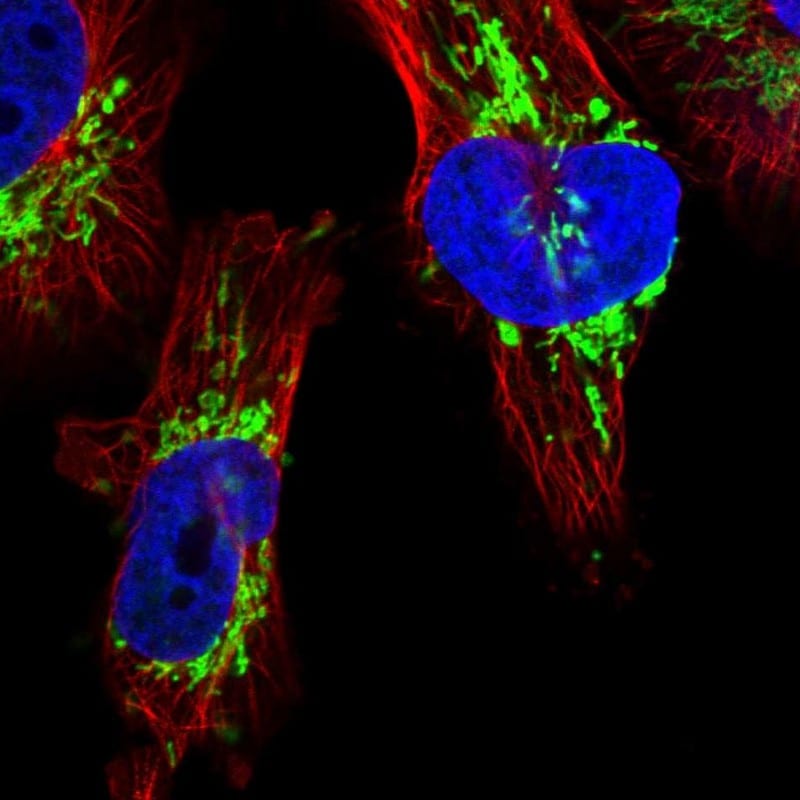 DSCR3 Antibody - BSA Free Immunocytochemistry/ Immunofluorescence: DSCR3 Antibody [NBP1-84296]