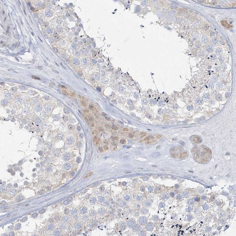 PCBD1 Antibody - BSA Free Immunohistochemistry-Paraffin: PCBD1 Antibody - BSA Free [NBP1-84297]