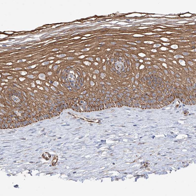 DCDC2 Antibody - BSA Free Immunohistochemistry-Paraffin: DCDC2 Antibody - BSA Free [NBP1-84298]