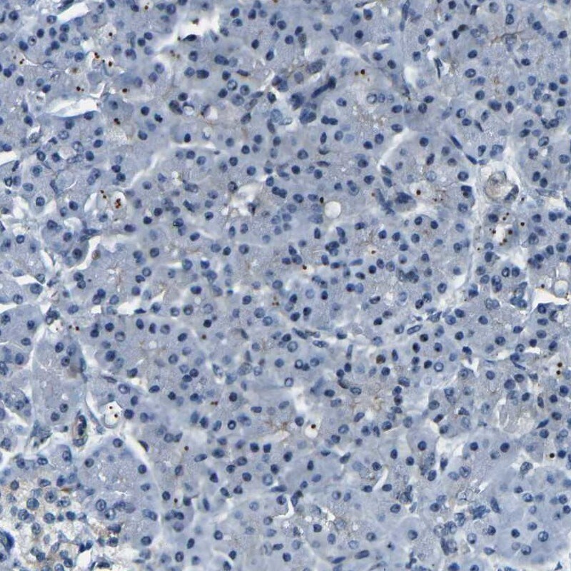 PARN Antibody - BSA Free Immunohistochemistry-Paraffin: PARN Antibody [NBP1-84303]