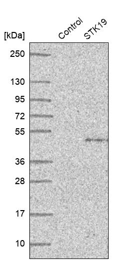 STK19 Antibody - BSA Free Western Blot: STK19 Antibody - BSA Free [NBP1-84308]
