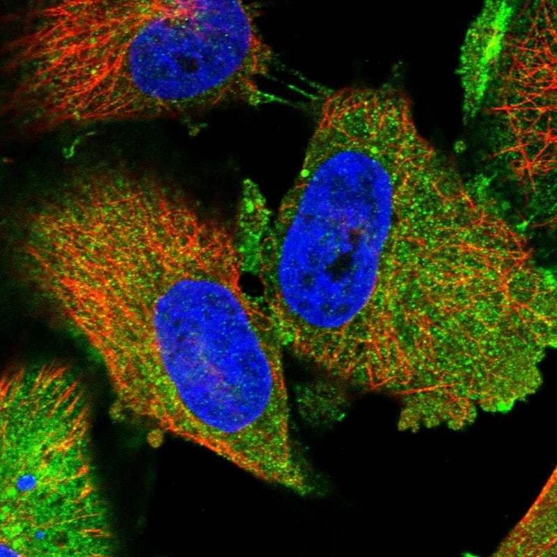 TPD52L1/D53 Antibody - BSA Free Immunocytochemistry/ Immunofluorescence: TPD52L1/D53 Antibody [NBP1-84313]