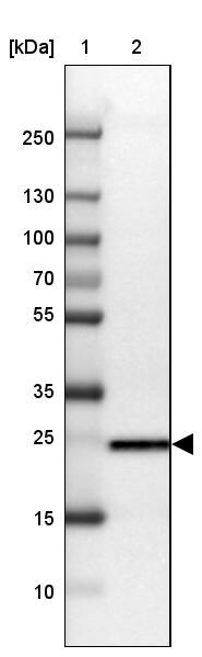 TPD52L1/D53 Antibody - BSA Free Western Blot: TPD52L1/D53 Antibody - BSA Free [NBP1-84314]