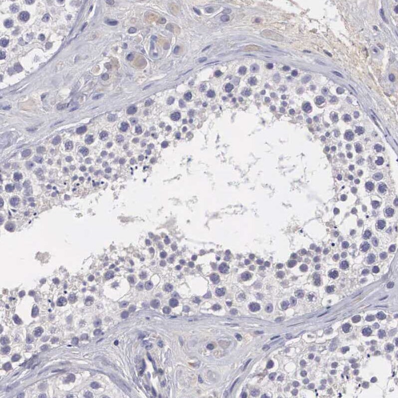 P311 Antibody - BSA Free Immunohistochemistry-Paraffin: P311 Antibody - BSA Free [NBP1-84315]