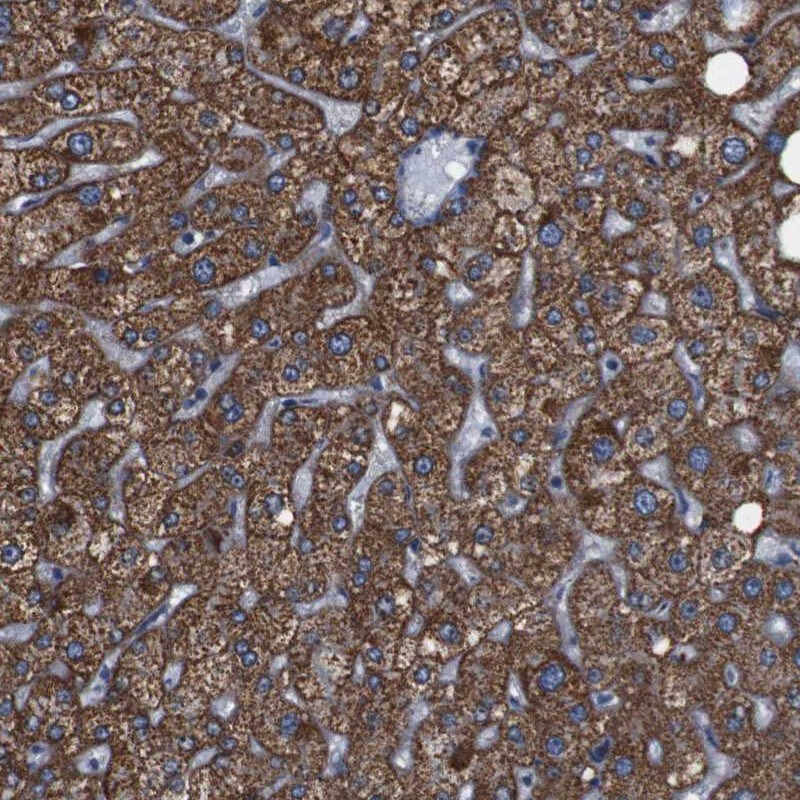 Gamma-Glutamyltransferase 7 Antibody - BSA Free Immunohistochemistry-Paraffin: Gamma-Glutamyltransferase 7 Antibody [NBP1-84319]