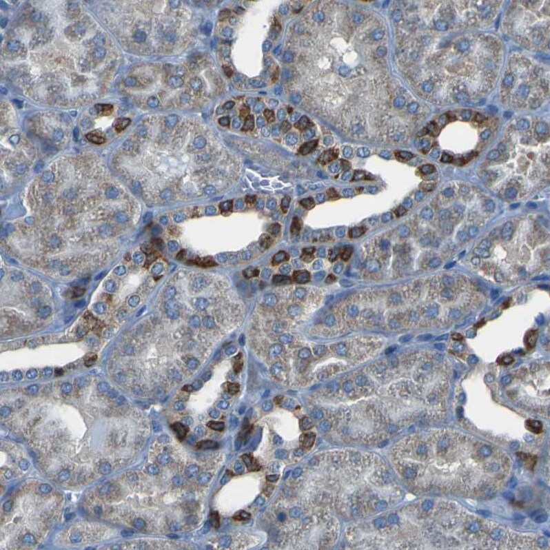 STIM1 Antibody - BSA Free Immunohistochemistry-Paraffin: STIM1 Antibody [NBP1-84323]