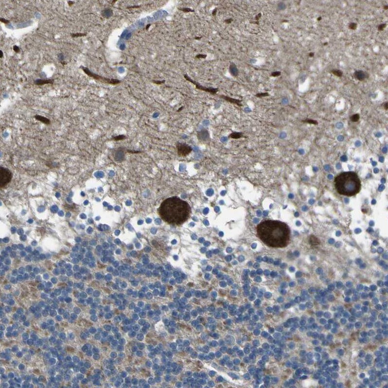 STIM1 Antibody - BSA Free Immunohistochemistry-Paraffin: STIM1 Antibody [NBP1-84323]
