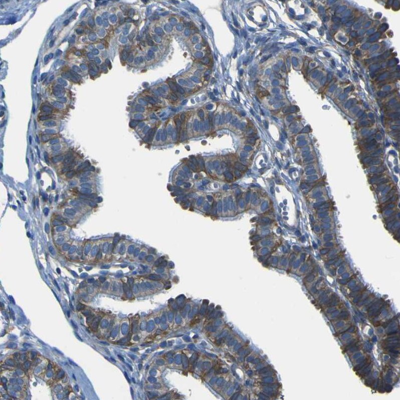 STIM1 Antibody - BSA Free Immunohistochemistry-Paraffin: STIM1 Antibody [NBP1-84323]