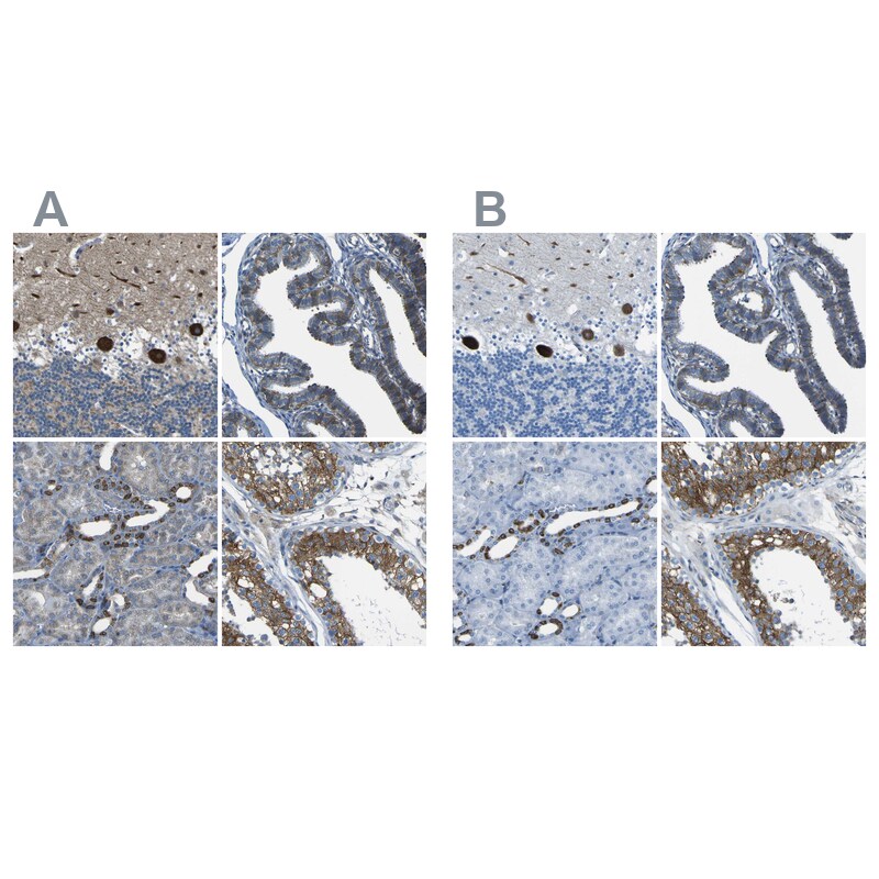 STIM1 Antibody - BSA Free Immunohistochemistry-Paraffin: STIM1 Antibody [NBP1-84323]