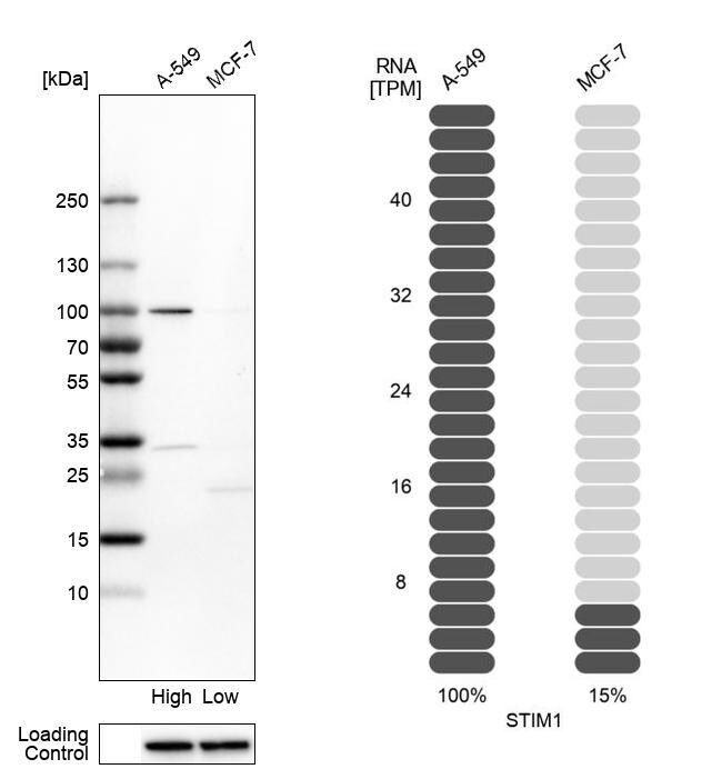 STIM1 Antibody - BSA Free Western Blot: STIM1 Antibody - BSA Free [NBP1-84323]