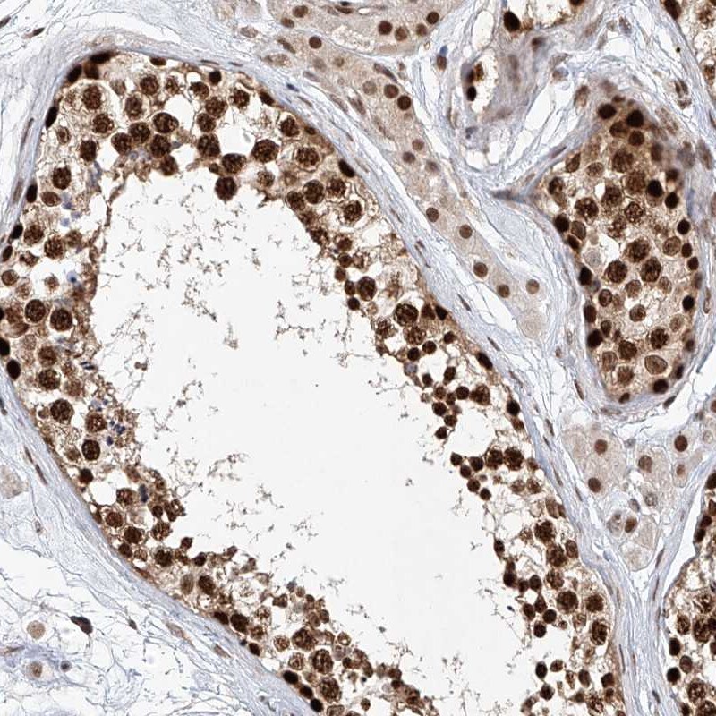 Zinc finger protein 470 Antibody - BSA Free Immunohistochemistry-Paraffin: Zinc finger protein 470 Antibody [NBP1-84324]