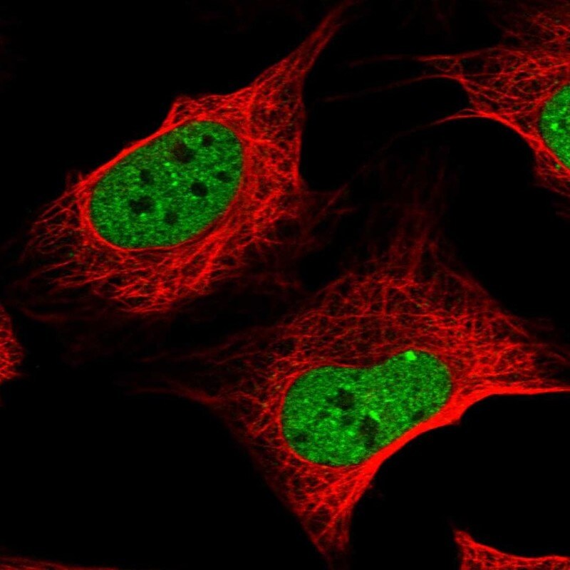 Zinc finger protein 470 Antibody - BSA Free Immunocytochemistry/ Immunofluorescence: Zinc finger protein 470 Antibody - BSA Free [NBP1-84324]