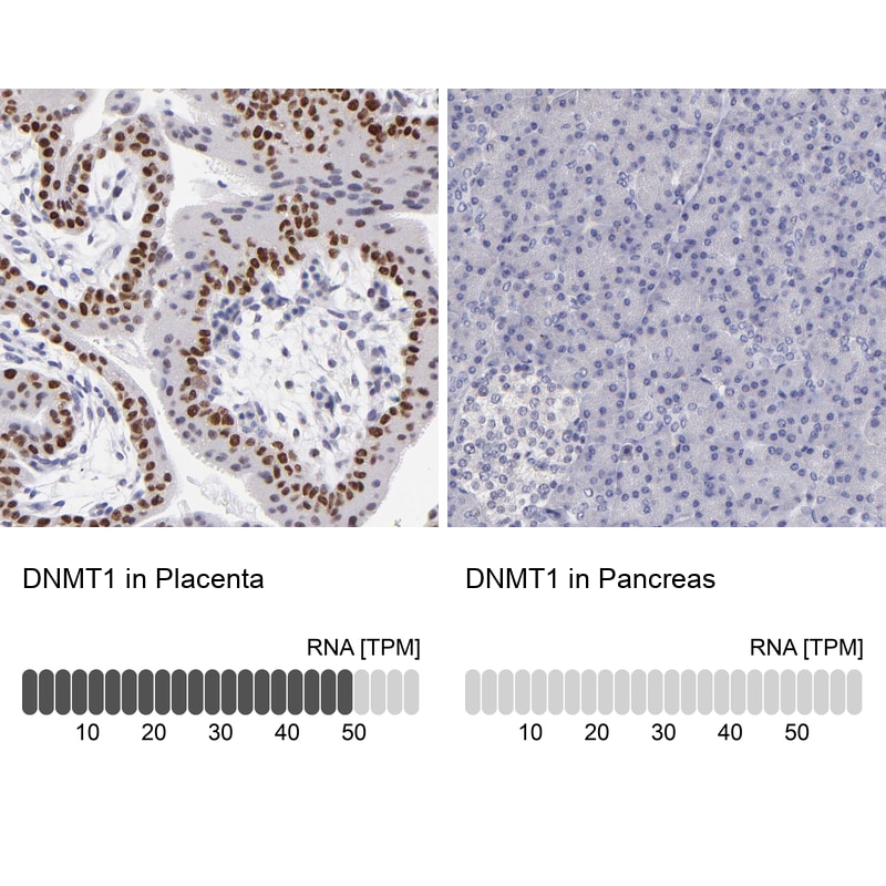 DNMT1 Antibody - BSA Free Immunohistochemistry-Paraffin: DNMT1 Antibody - BSA Free [NBP1-84328]