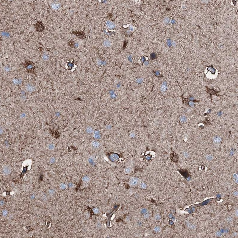 C1qTNF4/CTRP4 Antibody - BSA Free Immunohistochemistry-Paraffin: C1qTNF4/CTRP4 Antibody - BSA Free [NBP1-84335]