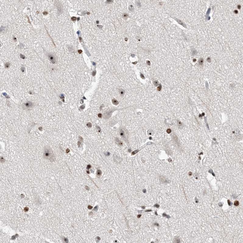 MPHOSPH10 Antibody - BSA Free Immunohistochemistry: MPHOSPH10 Antibody - BSA Free [NBP1-84341]