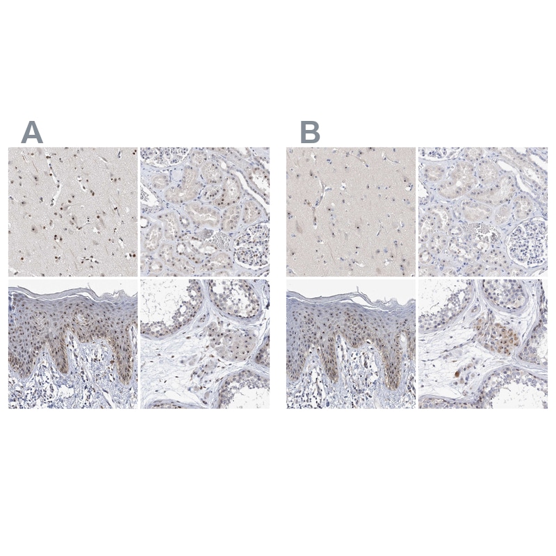 MPHOSPH10 Antibody - BSA Free Immunohistochemistry: MPHOSPH10 Antibody - BSA Free [NBP1-84341]
