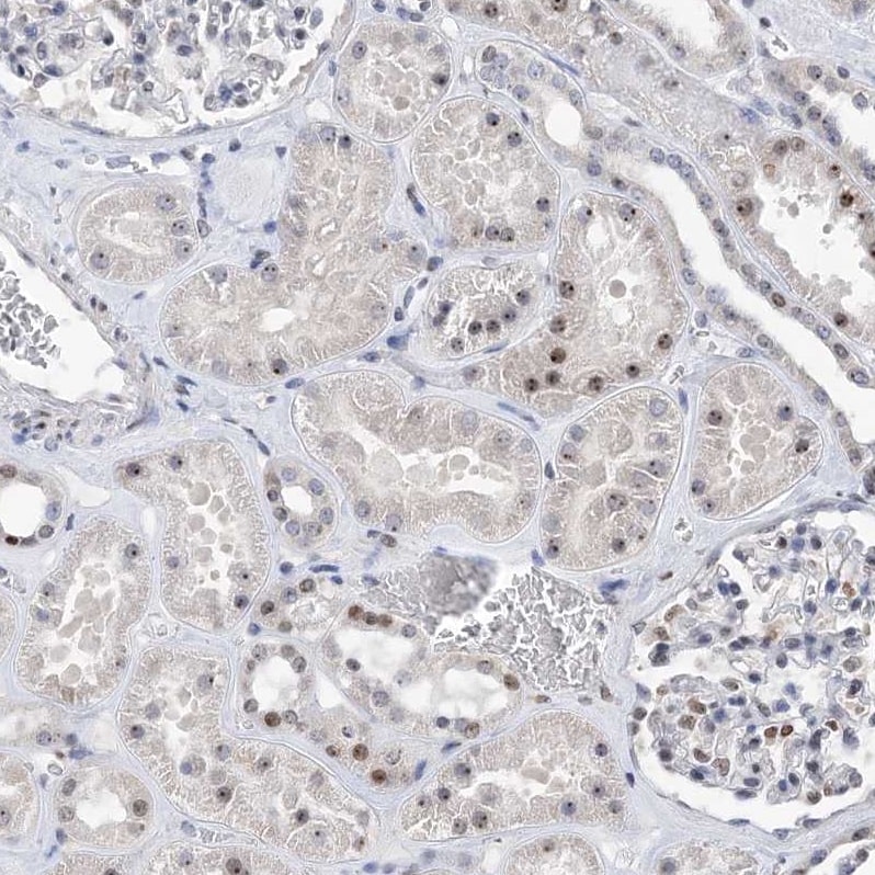 MPHOSPH10 Antibody - BSA Free Immunohistochemistry: MPHOSPH10 Antibody - BSA Free [NBP1-84341]