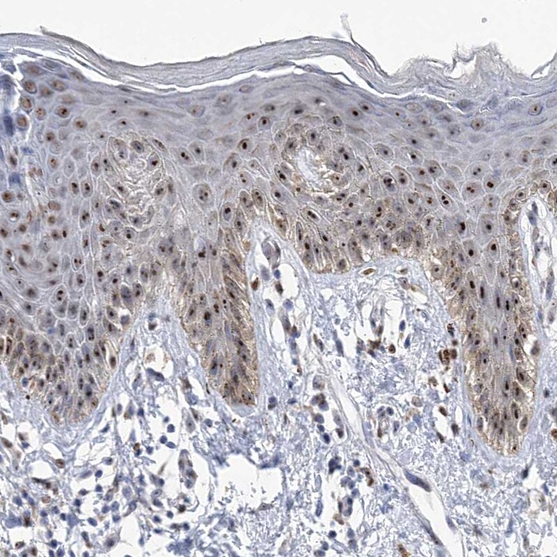 MPHOSPH10 Antibody - BSA Free Immunohistochemistry: MPHOSPH10 Antibody - BSA Free [NBP1-84341]